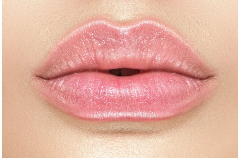 Woman after lip filler treatment