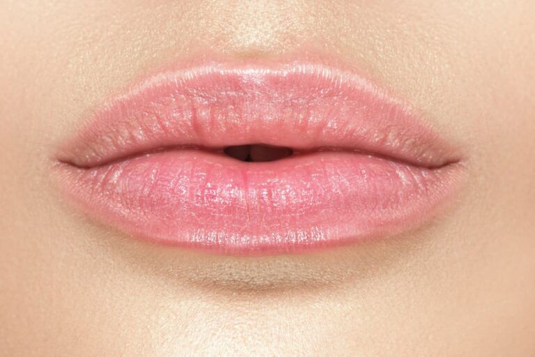 Woman before lip filler treatment